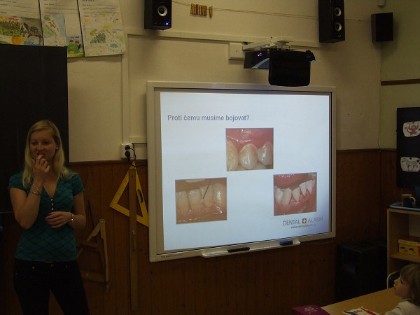 Dental prevention 25. 9. 2014